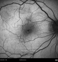 o10-ti15-2160709-20120525-002