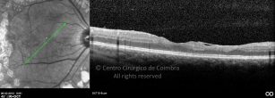 o11-ti03-2143334-20120306-002
