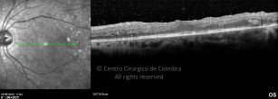 o11-ti03-2148807-20120518-006