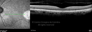 o11-ti03-2156425-20120105-023