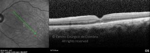 o11-ti03-2160324-20120420-007