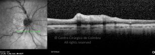 o11-ti03-274-20100623-016