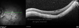 o11-ti03-4870-20100624-007