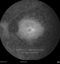 o11-ti15-131915-20100409-060