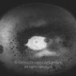 o11-ti15-4444-20120418-989