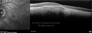 o12-ti03-2149554-20110718-007