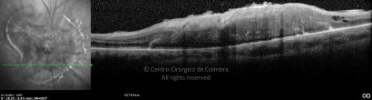 o12-ti03-2151183-20111021-008