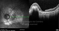 o12-ti03-4417-20120417-006