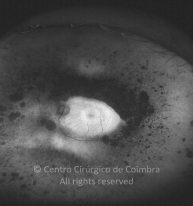 o12-ti15-4444-20120418-995