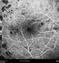 o13-ti07-2159491-20120420-009