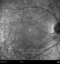 o13-ti16-131915-20100409-006
