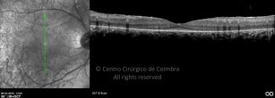 o15-ti03-131915-20100409-008