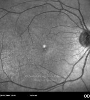 o15-ti16-121746-20090825-006