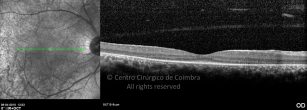 o16-ti03-131915-20100409-020