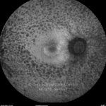 o16-ti15-993-20100419-004