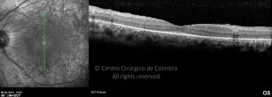 o17-ti03-131915-20100409-032