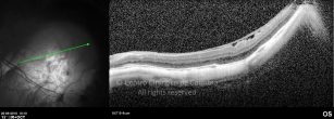 o17-ti03-4870-20100920-005