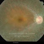 o18-ti02-2159988-20120424-002