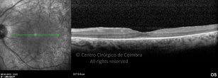 o18-ti03-131915-20100409-044