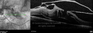 o18-ti03-2171129-20130326-028