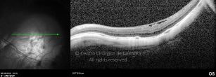 o18-ti03-4870-20100920-006