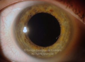 o18-ti12-4870-20120209-001