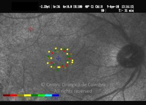 o19-ti14-131915-20100409-002
