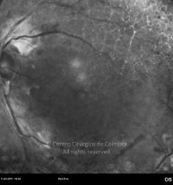 o20-ti01-5163-20110311-001