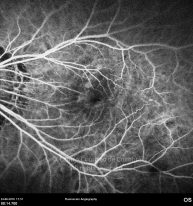o20-ti07-4870-20100624-011