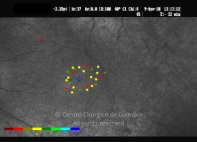 o20-ti14-131915-20100409-001
