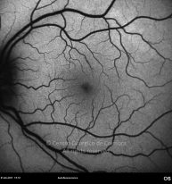 o20-ti15-18437-20110401-004