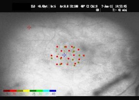 o21-ti14-2138876-20110607-009