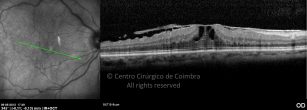 o22-ti03-2160709-20120509-015