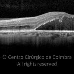 o22-ti03-2192611-20141015-635