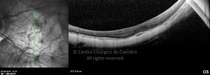 o23-ti03-4870-20100922-001