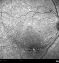 o23-ti16-2138625-20101124-005