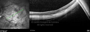 o25-ti03-4870-20100922-003