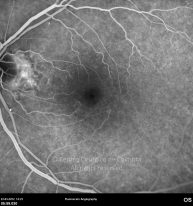 o25-ti07-2156640-20120322-012