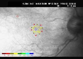 o25-ti21-2157305-20120209-002
