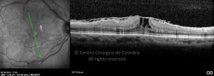 o26-ti03-2160709-20120509-019