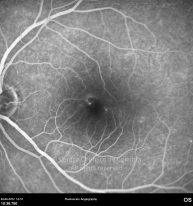 o27-ti07-3251-20120404-018