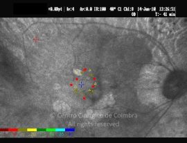 o27-ti14-126920-20100614-001