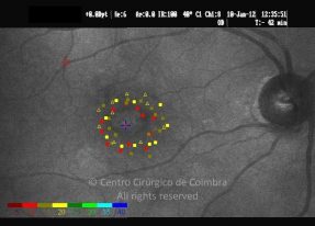 o27-ti14-2155976-20120110-096