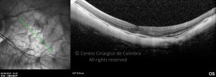 o29-ti03-4870-20100922-007