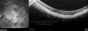 o30-ti03-4870-20100922-008