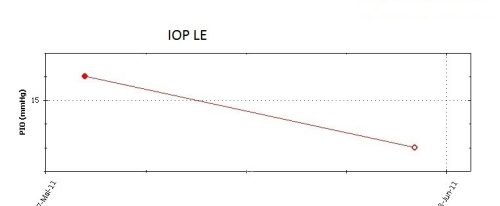 o30-ti21-2148012-20110601-001