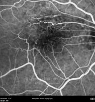o31-ti06-2136744-20111026-031