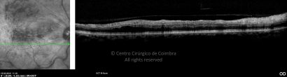 o32-ti03-2159491-20120315-023