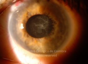 o32-ti12-4870-20100923-002