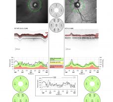 o33-ti10-2158247-20120208-044